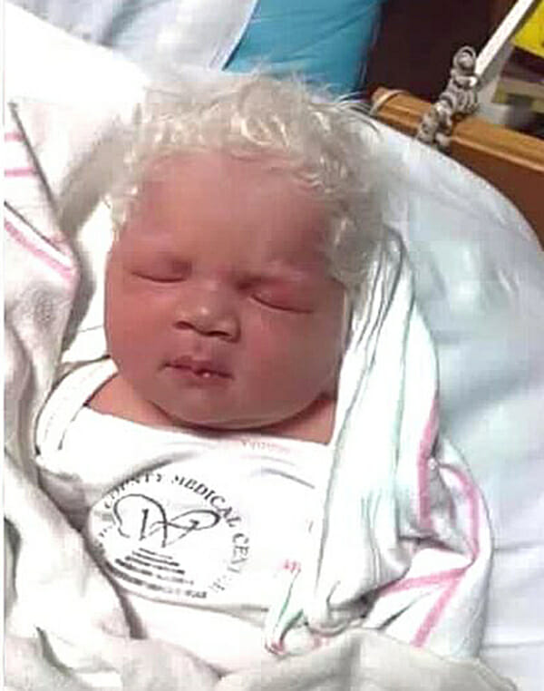 Baby boy born with snow-white hair dubbed Prince Charming